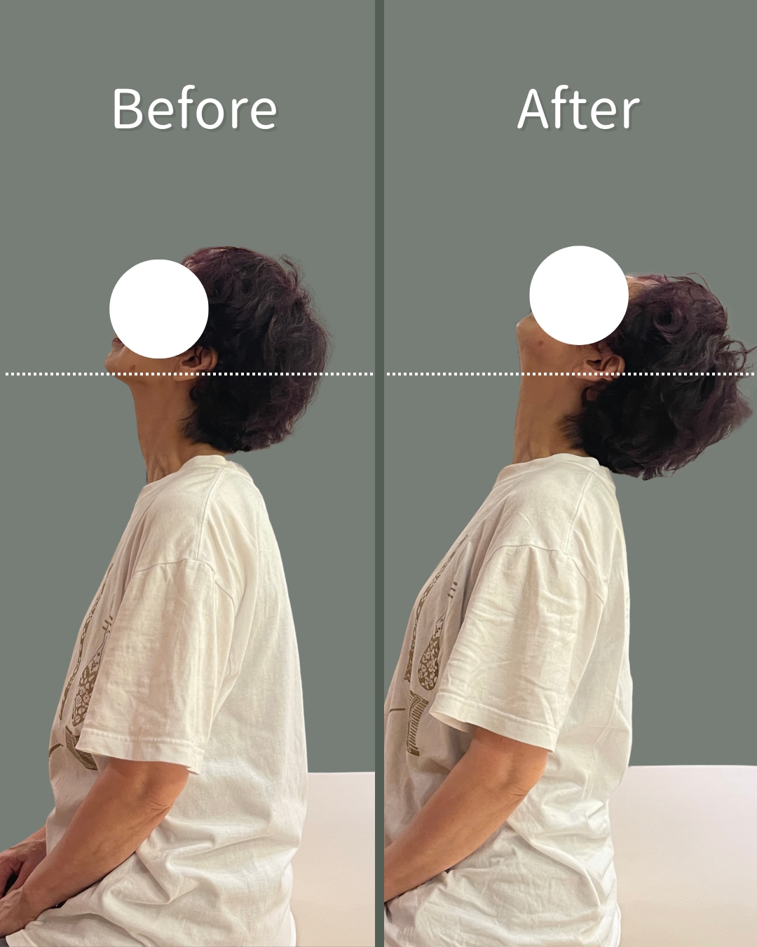 Before After 1