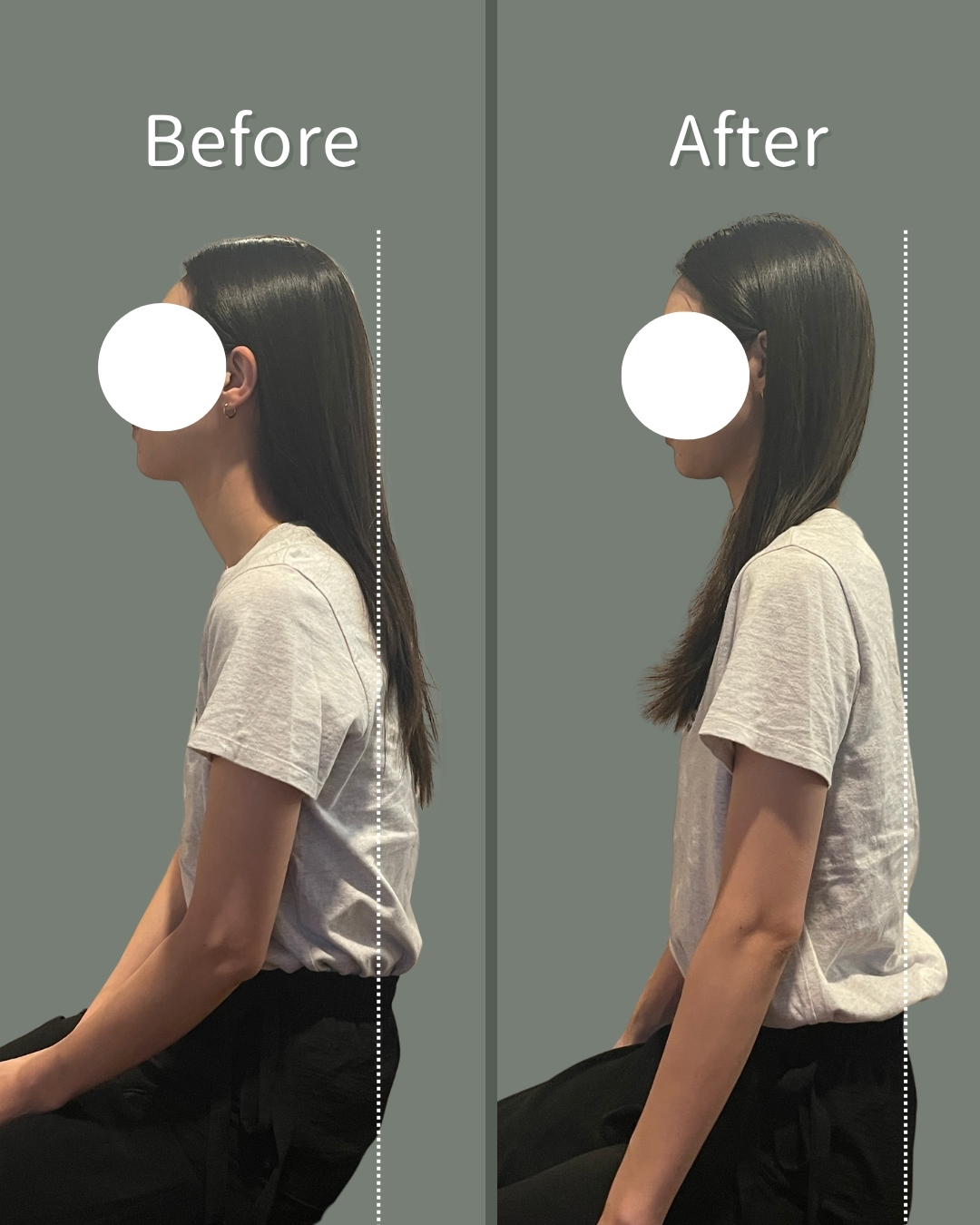 Before After 2