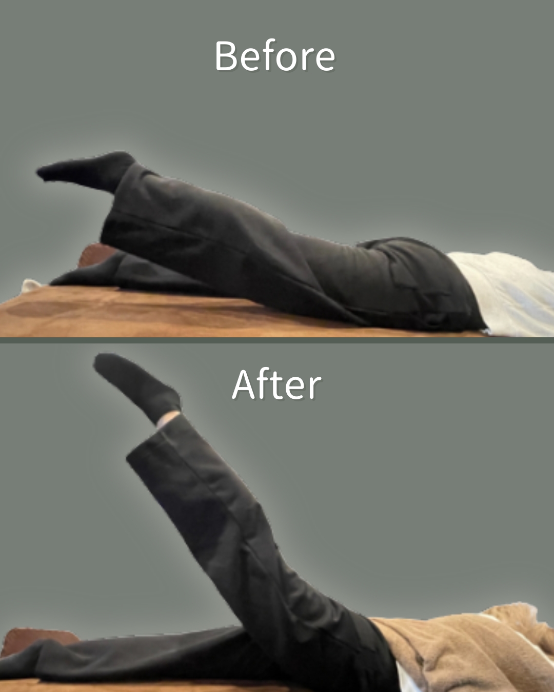 Before After 3